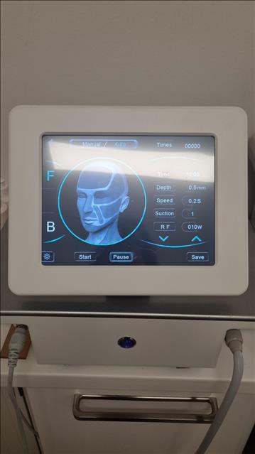 RF-microneedling V-shape