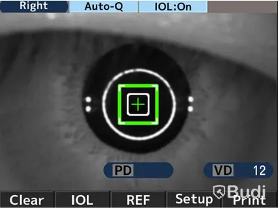 Autorefraktor/Keratometer AKR 550 TS - Essilor.