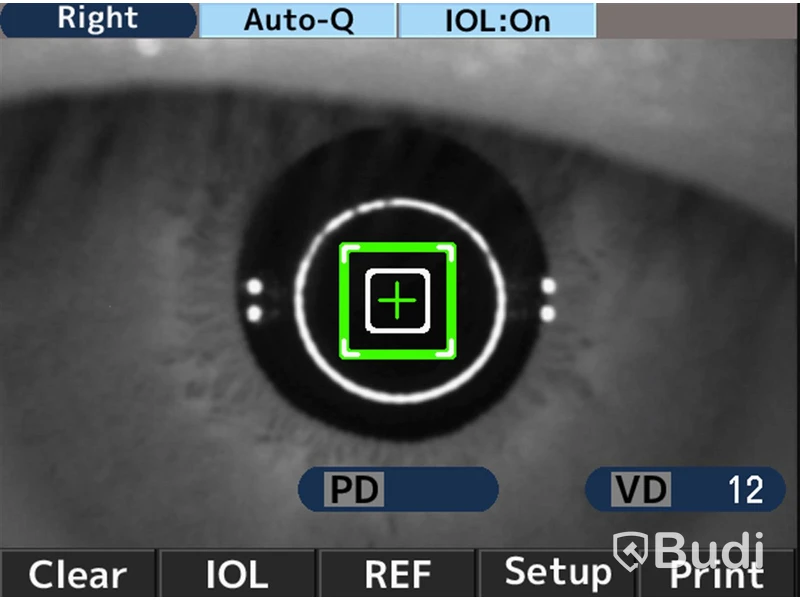 Autorefraktor/Keratometer AKR 550 TS - Essilor.