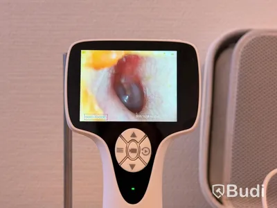 Video otoskop, BD-VOT -2024