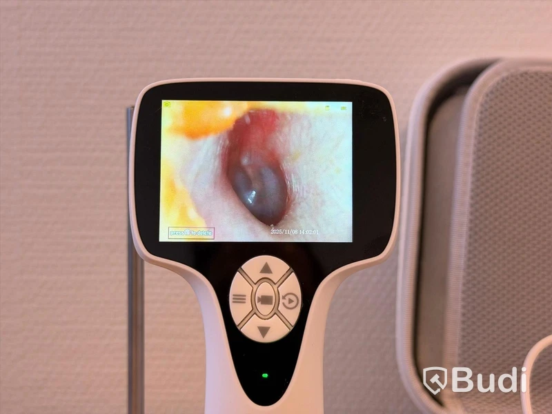 Video otoskop, BD-VOT -2024