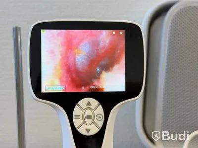 Video otoskop, BD-VOT -2024