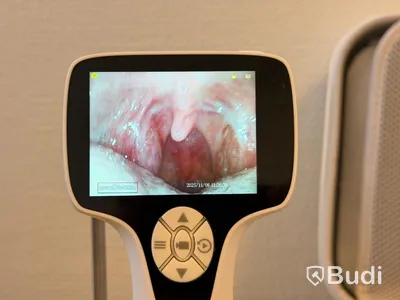 Video otoskop, BD-VOT -2024