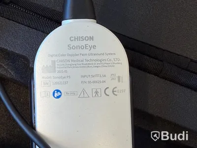 Ultraljud, Chison SonoEye P5 med Lenovo tablet