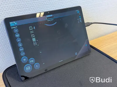 Ultraljud, Chison SonoEye P5 med Lenovo tablet